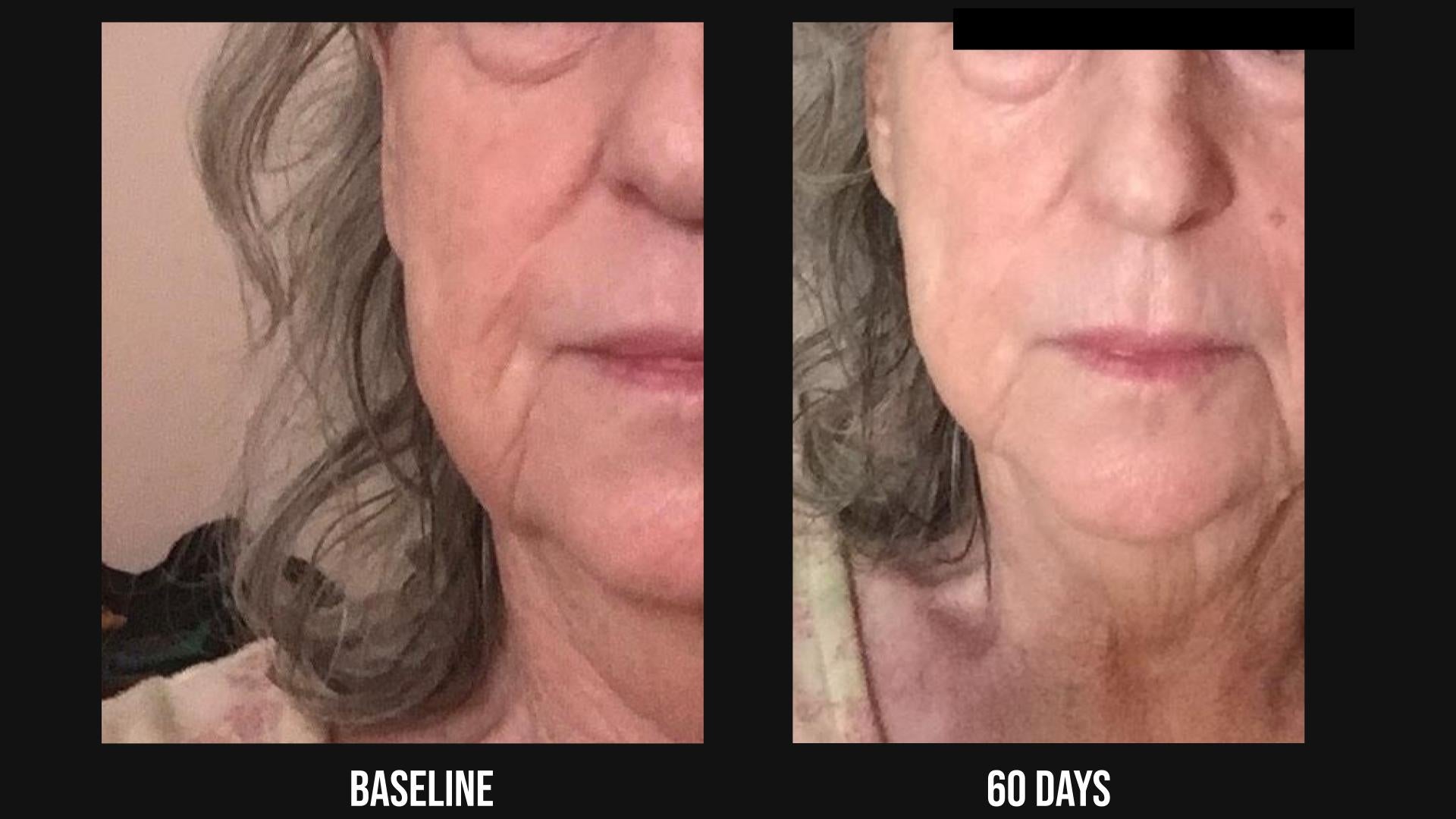 SIV™ Biome Balancing Serum