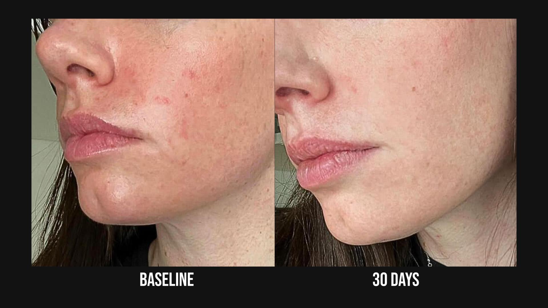 SIV™ Biome Balancing Serum