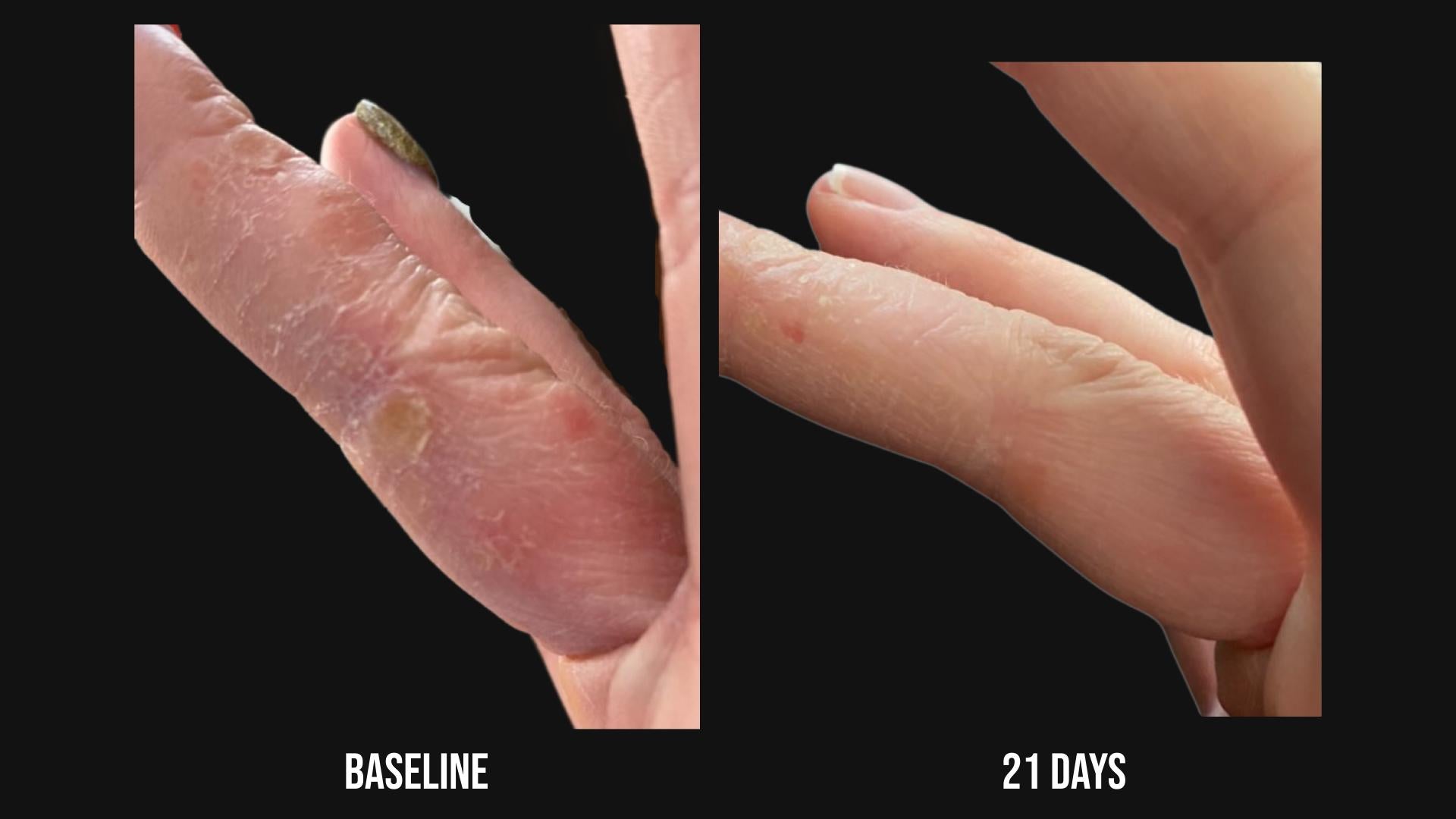 SIV™ Biome Balancing Serum