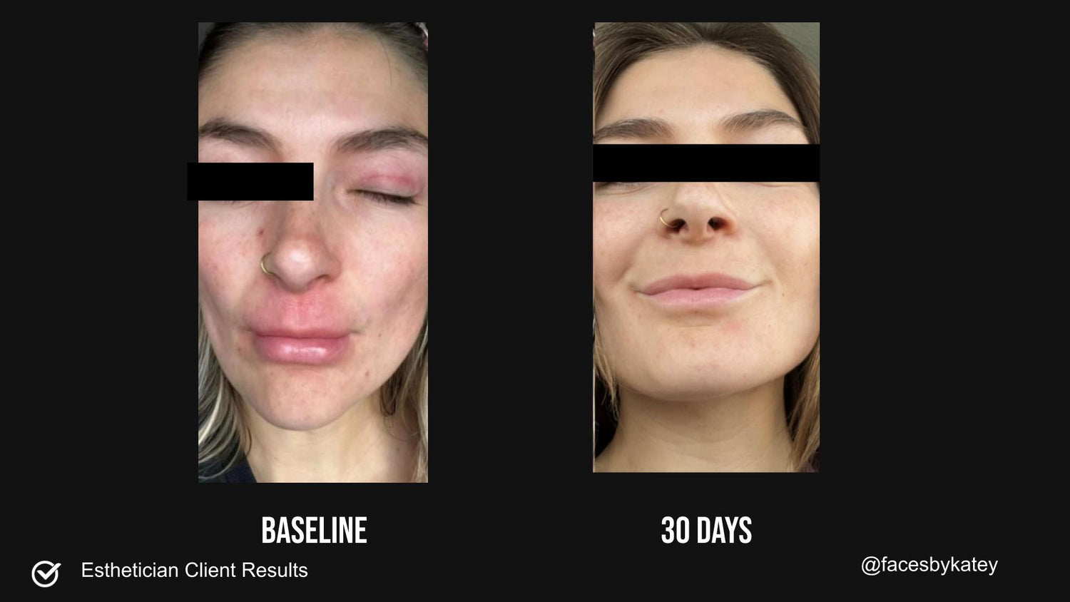 SIV™ Biome Balancing Serum
