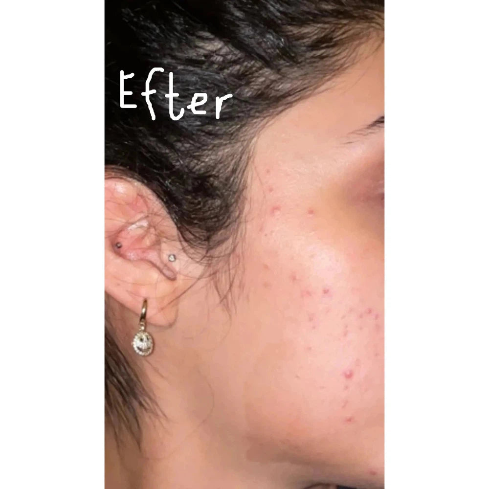 SIV™ Biome Balancing Serum
