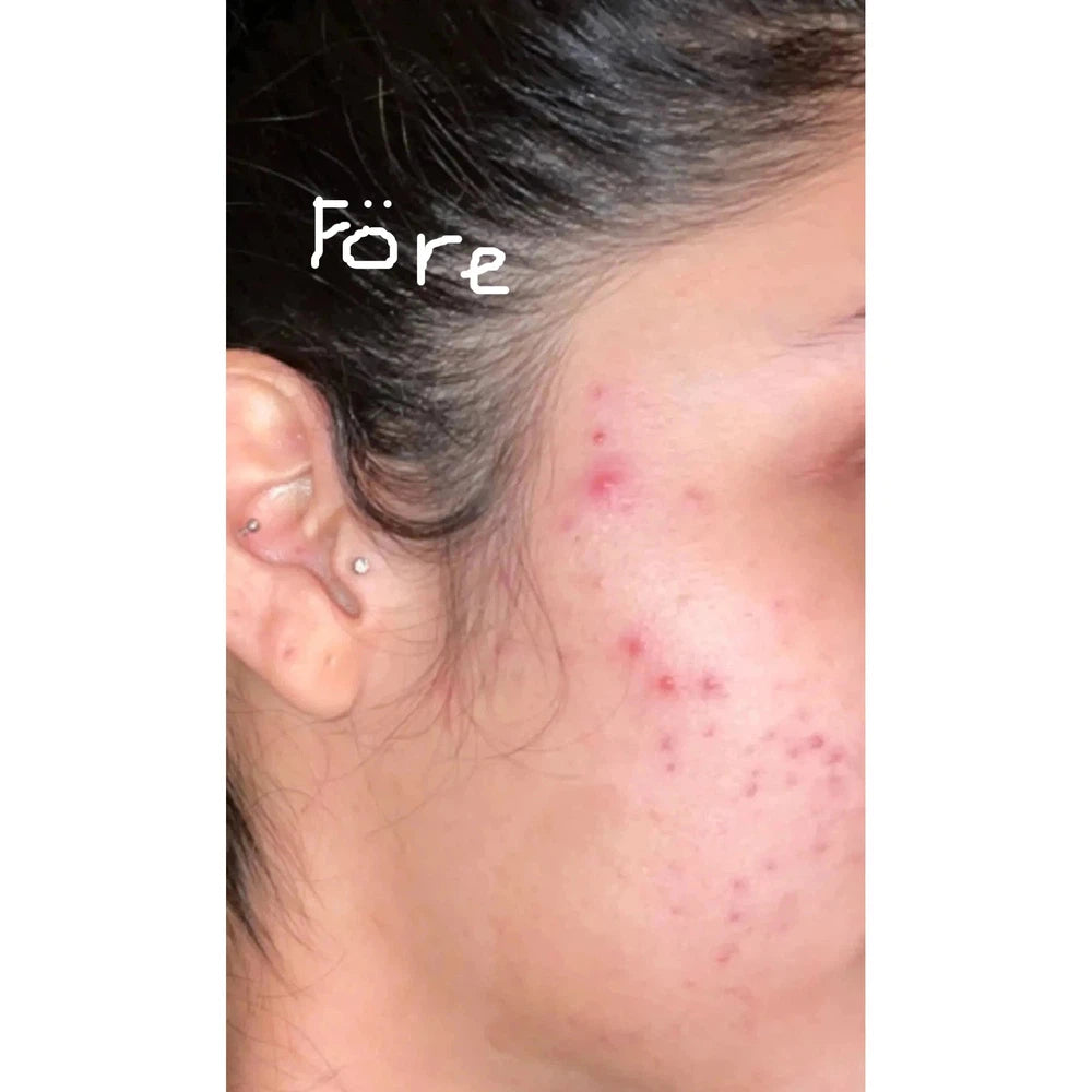 SIV™ Biome Balancing Serum