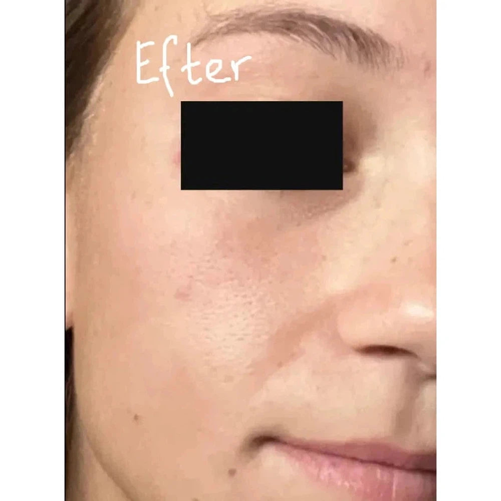 SIV™ Biome Balancing Serum