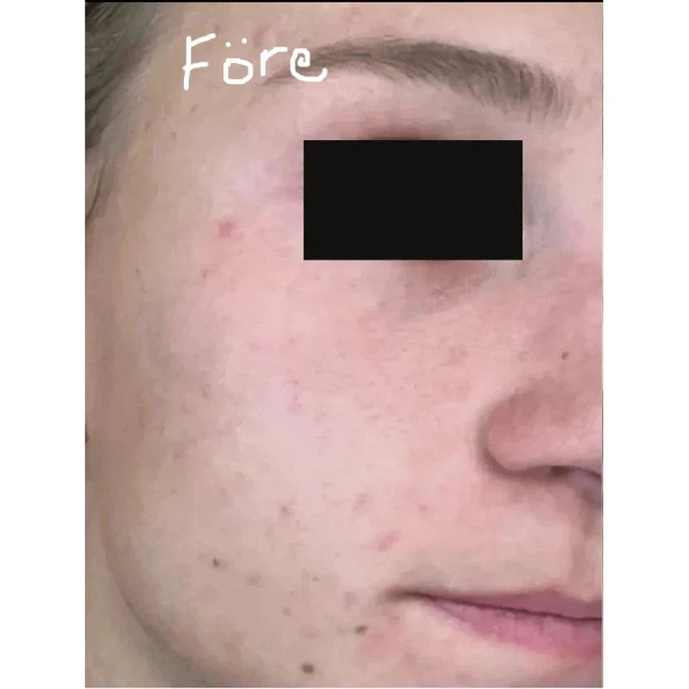 SIV™ Biome Balancing Serum